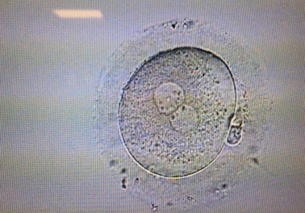 是卵子不好还是没受精？深扒0pn胚胎形成的原因