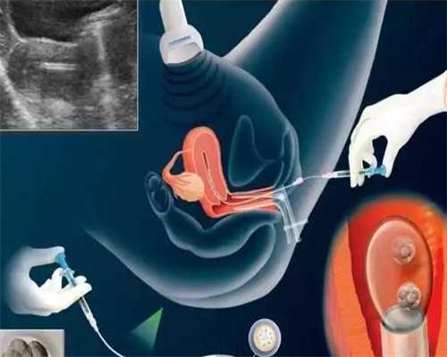 武汉代孕官网,卵巢癌患者的饮食指南 卵巢癌饮食