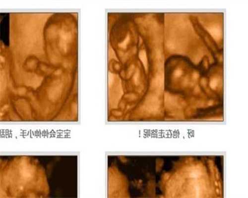 武汉代孕机构_饮食养胎法(5)