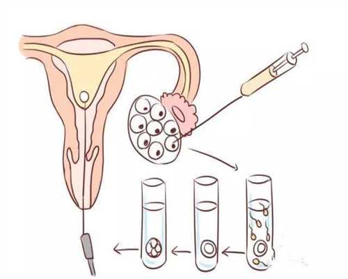 代孕网哪家靠谱_代孕期间宫缩如何处理